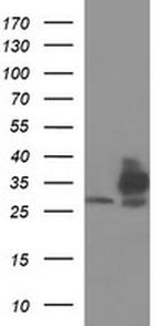 TMX1 Antibody in Western Blot (WB)