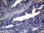 TNFRSF10B Antibody in Immunohistochemistry (Paraffin) (IHC (P))