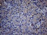 TNFRSF10B Antibody in Immunohistochemistry (Paraffin) (IHC (P))