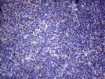 TNFRSF10B Antibody in Immunohistochemistry (Paraffin) (IHC (P))