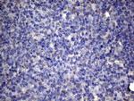 TNFRSF10B Antibody in Immunohistochemistry (Paraffin) (IHC (P))