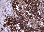 TNFRSF8 Antibody in Immunohistochemistry (Paraffin) (IHC (P))