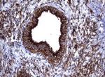 TNFRSF8 Antibody in Immunohistochemistry (Paraffin) (IHC (P))