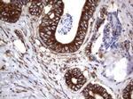 TNFRSF8 Antibody in Immunohistochemistry (Paraffin) (IHC (P))