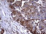 TNFRSF8 Antibody in Immunohistochemistry (Paraffin) (IHC (P))