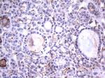 TNFRSF8 Antibody in Immunohistochemistry (Paraffin) (IHC (P))