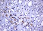 TNFRSF8 Antibody in Immunohistochemistry (Paraffin) (IHC (P))