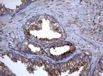 TNFRSF8 Antibody in Immunohistochemistry (Paraffin) (IHC (P))