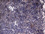 TNFRSF8 Antibody in Immunohistochemistry (Paraffin) (IHC (P))