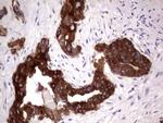 TNFRSF8 Antibody in Immunohistochemistry (Paraffin) (IHC (P))