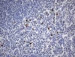 TNFRSF8 Antibody in Immunohistochemistry (Paraffin) (IHC (P))