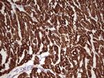 TNNI1 Antibody in Immunohistochemistry (Paraffin) (IHC (P))