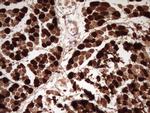 TNNI2 Antibody in Immunohistochemistry (Paraffin) (IHC (P))