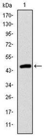 TNNI2 Antibody in Western Blot (WB)