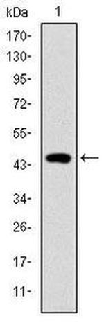 TNNI2 Antibody in Western Blot (WB)