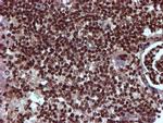 TOMM34 Antibody in Immunohistochemistry (Paraffin) (IHC (P))