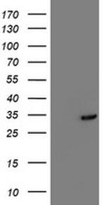 TOMM34 Antibody in Western Blot (WB)