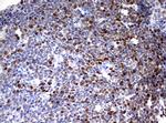 TOP2A Antibody in Immunohistochemistry (Paraffin) (IHC (P))