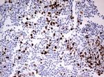 TOP2A Antibody in Immunohistochemistry (Paraffin) (IHC (P))