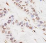 TORC3 Antibody in Immunohistochemistry (IHC)