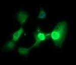 TP73 Antibody in Immunocytochemistry (ICC/IF)