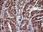 TP73 Antibody in Immunohistochemistry (Paraffin) (IHC (P))