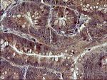 TP73 Antibody in Immunohistochemistry (Paraffin) (IHC (P))