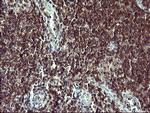 TP73 Antibody in Immunohistochemistry (Paraffin) (IHC (P))