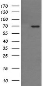 TP73 Antibody in Western Blot (WB)