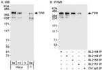 TPR Antibody in Western Blot (WB)