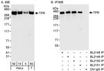 TPR Antibody in Western Blot (WB)