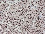 TPRKB Antibody in Immunohistochemistry (Paraffin) (IHC (P))