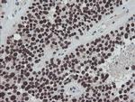 TPRKB Antibody in Immunohistochemistry (Paraffin) (IHC (P))