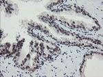 TPRKB Antibody in Immunohistochemistry (Paraffin) (IHC (P))