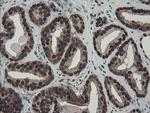 TPRKB Antibody in Immunohistochemistry (Paraffin) (IHC (P))