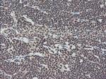 TPRKB Antibody in Immunohistochemistry (Paraffin) (IHC (P))