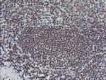 TPRKB Antibody in Immunohistochemistry (Paraffin) (IHC (P))