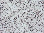 TPRKB Antibody in Immunohistochemistry (Paraffin) (IHC (P))