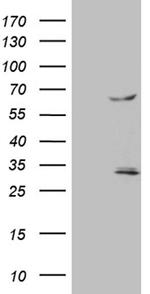 TRAF5 Antibody in Western Blot (WB)