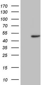 TRIB1 Antibody in Western Blot (WB)