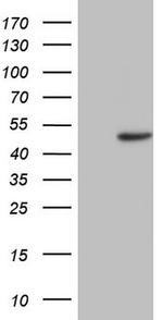 TRIB1 Antibody in Western Blot (WB)