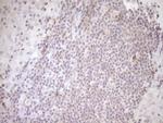 TRIB3 Antibody in Immunohistochemistry (Paraffin) (IHC (P))