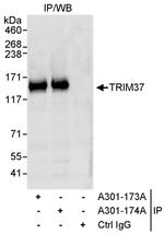 TRIM37 Antibody in Immunoprecipitation (IP)
