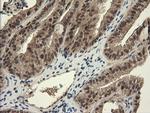 TRIM45 Antibody in Immunohistochemistry (Paraffin) (IHC (P))