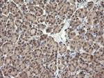 TRIM45 Antibody in Immunohistochemistry (Paraffin) (IHC (P))