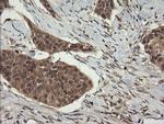 TRIM45 Antibody in Immunohistochemistry (Paraffin) (IHC (P))