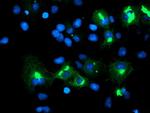 TRIM9 Antibody in Immunocytochemistry (ICC/IF)