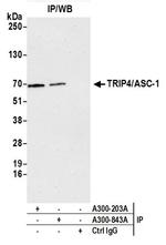 TRIP4/ASC-1 Antibody in Western Blot (WB)