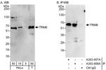 TRM6 Antibody in Western Blot (WB)