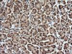 TRMT2A Antibody in Immunohistochemistry (Paraffin) (IHC (P))